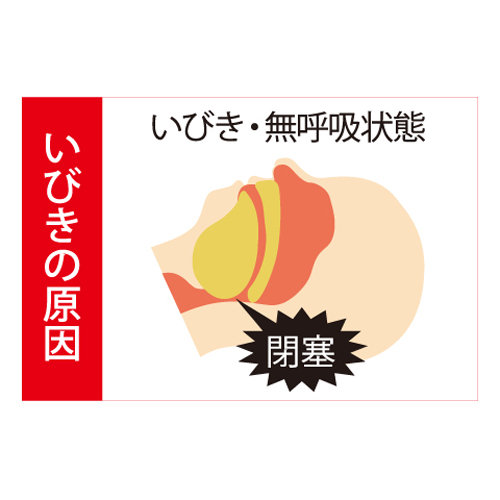 いびき防止グッズの仕組み